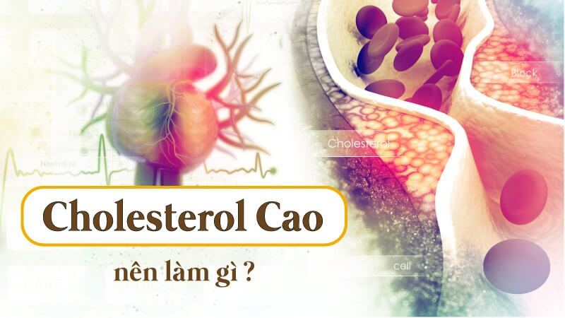 Cholesterol cao là gì? Nên làm gì khi cholesterol tăng cao?
